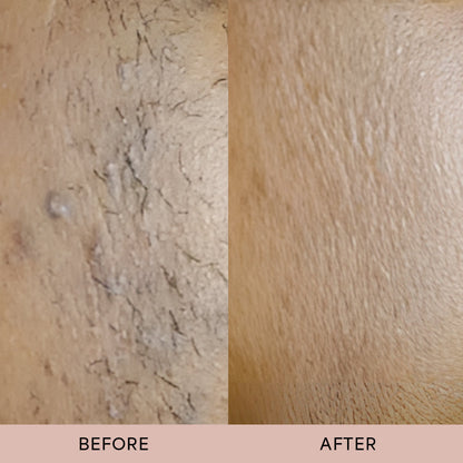 Dermave™ After Trim Oil