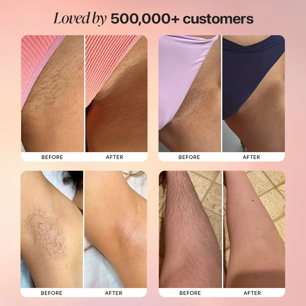 Dermave™ Electric Trimmer 2.0